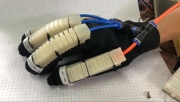 Sinh viên làm găng tay robot hỗ trợ người đột quỵ